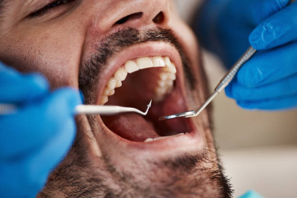Best Emergency Dental Care for Abscessed Tooth in Long Branch, VA