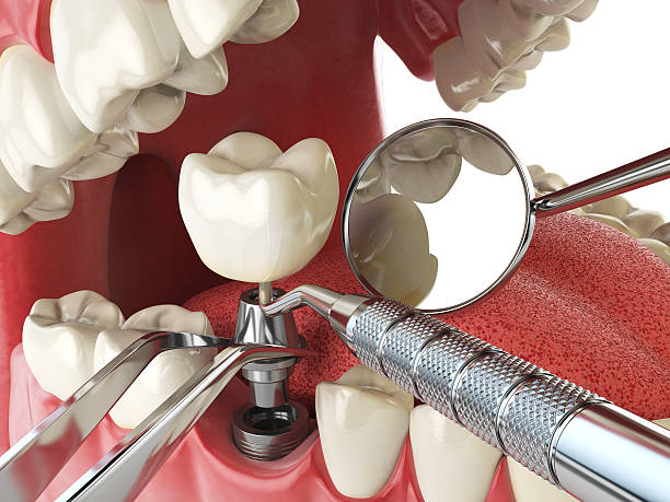Best Urgent Dental Care for Toothache in Long Branch, VA